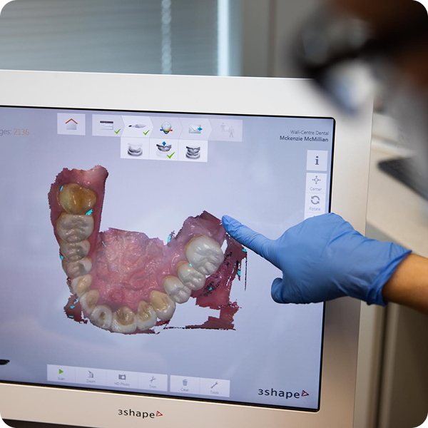 Someone pointing at a screen that has the roof of a mouth displayed.